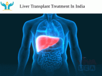 Liver transplant treatment in India