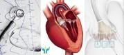 Heart and Cardiology Treatment in India | India Health Help