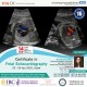Certificate Course in Fetal Echocardiography