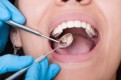 Get Treated at the Best Dental Clinic in Abu Dhabi