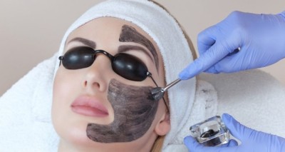  carbon laser facial | best skin specialist