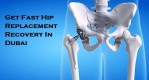 Get Fast Hip Replacement Recovery In Dubai