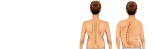 Effective scoliosis treatment By Dr. Sherief Elsayed