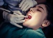 Root Canal Treatment Cost in Dubai & Connect to Best Dentist