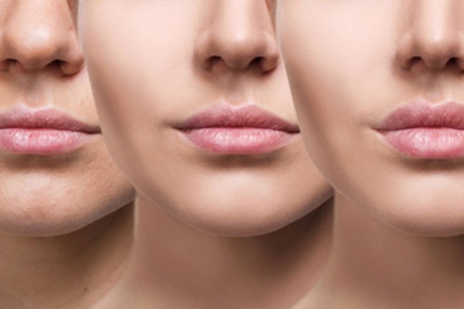 Best Lip Enhancement Treatment