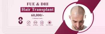 Hair transplant surgery in Hyderabad