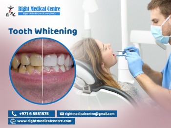 Best Dental Clinic For Root Canal Treatment, Tooth Filling, Sharjah 