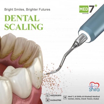 Dental-scaling-Dentistry-in-Deira