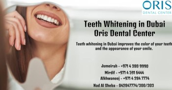Teeth Whitening in Dubai-Best Dental Clinic in Dubai - Oris Dental Center