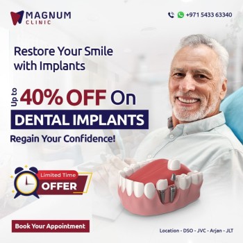 Magnum Dental Clinic - Dental Implant in Dubai