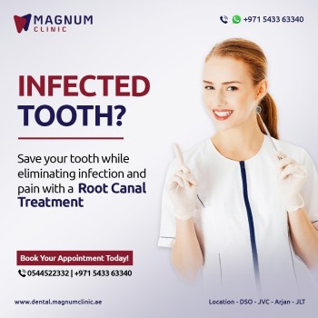 Magnum Dental Clinic - Root Canal Treatment in Dubai