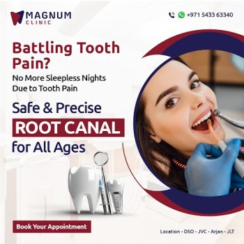 Root Canal Treatment in Dubai