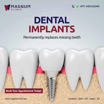 Magnum Dental Clinic - Dental Implnat and replace missing tooth treatment in Dubai