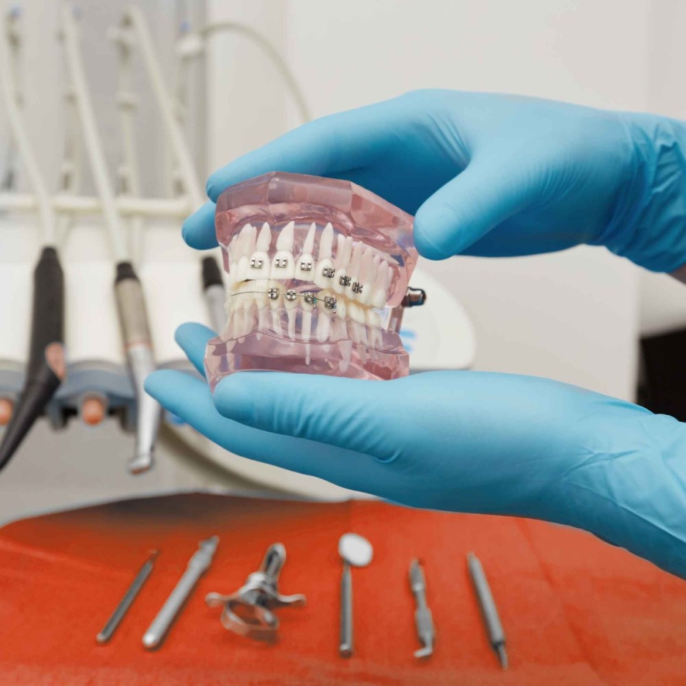 Teeth Braces in Dubai 