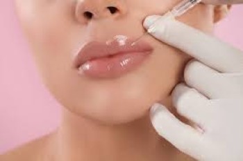 Lip Fillers Dubai 