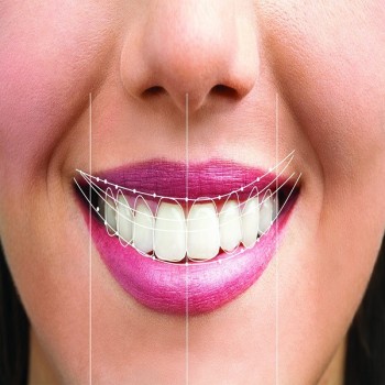 Best Smile designing clinic in Dubai UAE