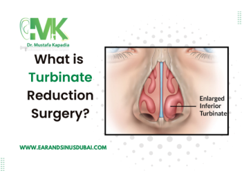 Turbinate Reduction: Turbinate Reduction Surgery & Procedure