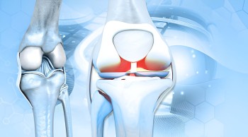 Loud Pop In Knee Followed By Pain